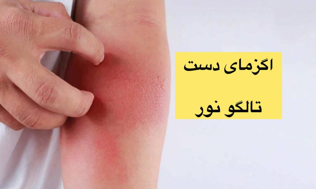 عکس و تصاویر انواع اگزمای پوستی