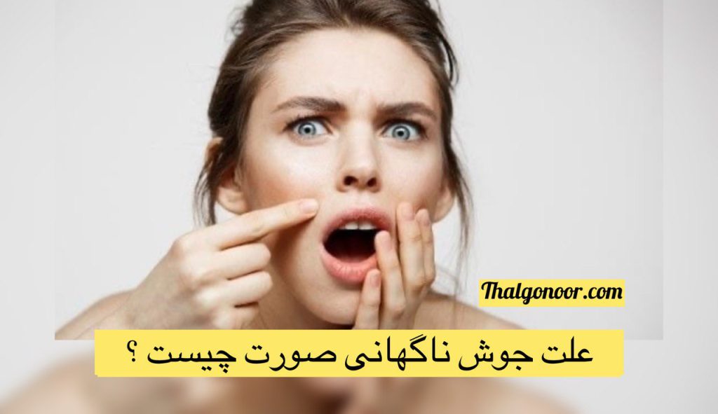 علت جوش ناگهانی صورت چیست؟