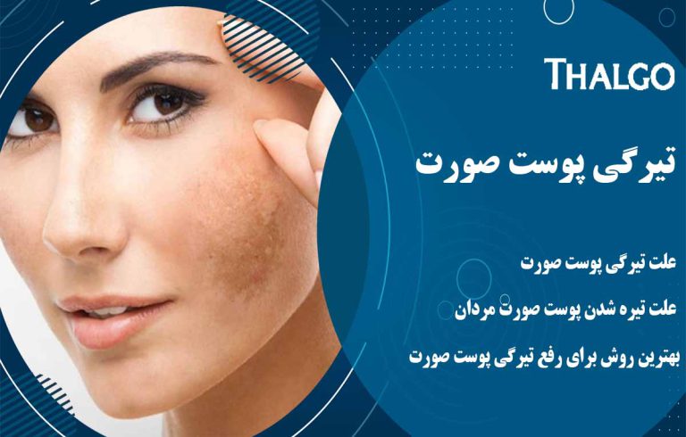تیرگی پوست صورت به همراه عوامل و راه های درمانی و رفع تیرگی پوست صورت